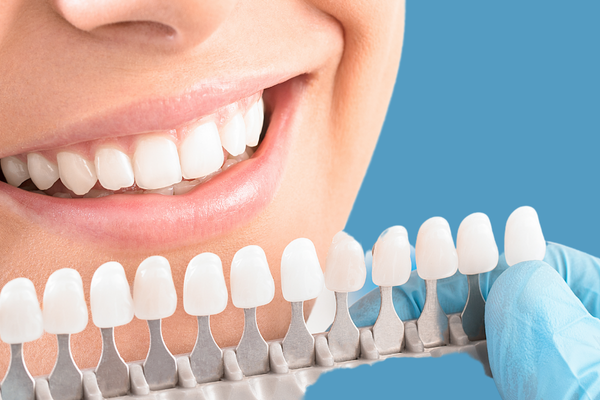 Estética Dental